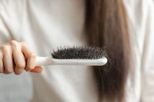Read more about the article A változókori hajhullás okai, tünetei és kezelési lehetőségei